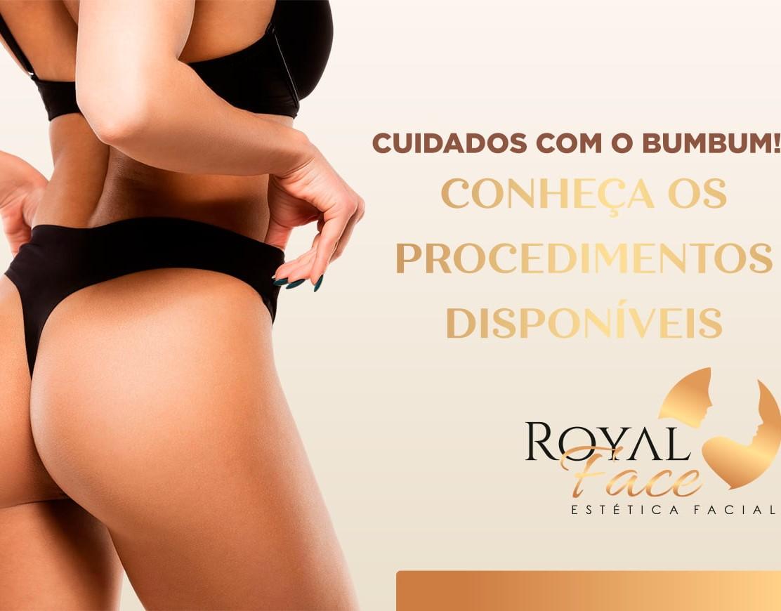 Perfect Glúteo Royal Face