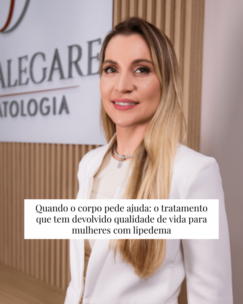 Quando o corpo pede ajuda: o tratamento que tem devolvido qualidade de vida para mulheres com lipedema