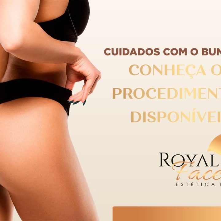 royal face catanduva revista top